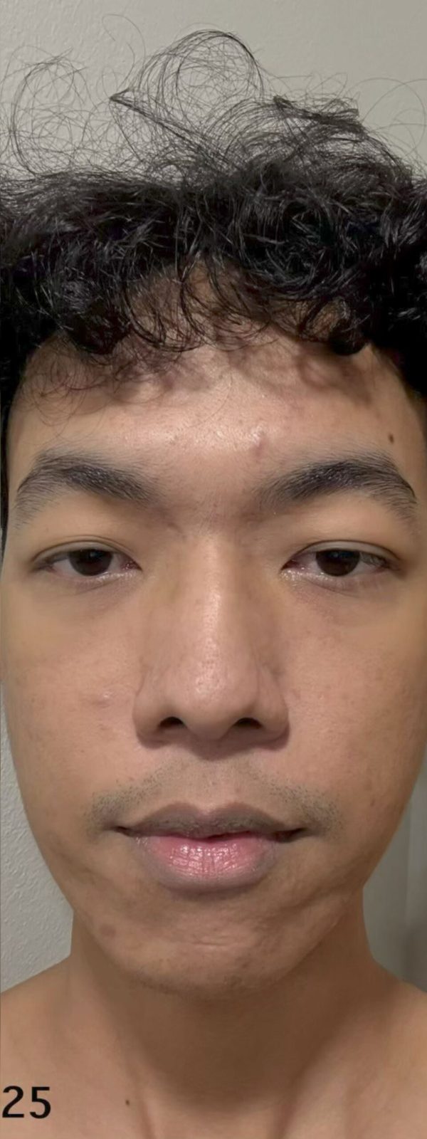 After คุณเติก